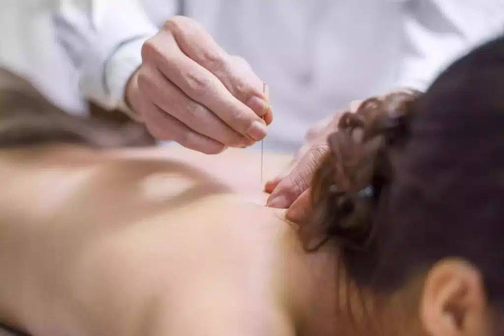 דיקור סיני נמצא כיעיל בטיפול בכאבי גב וצוואר-בריאות בקליק